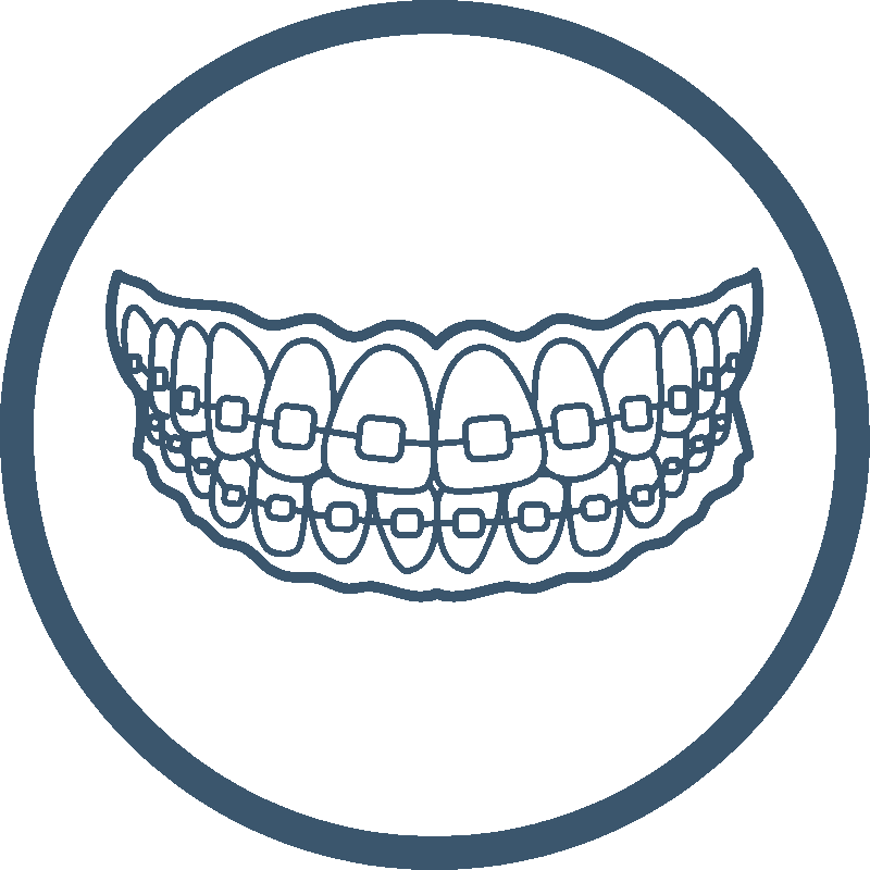 Minimal teal line icon of braces on teeth, illustrating the classic orthodontic method for straightening smiles – Washington Orthodontics.