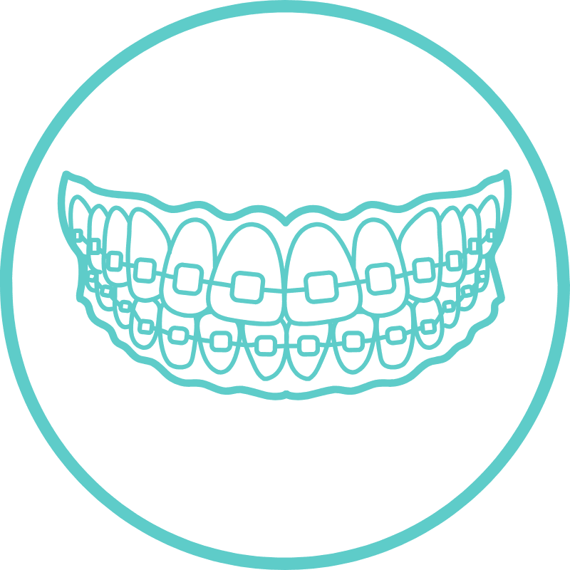 Minimal teal line icon of braces on teeth, illustrating the classic orthodontic method for straightening smiles – Washington Orthodontics.