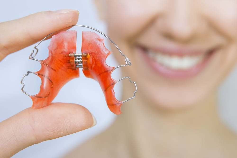 A woman holds a red dental retainer, smiling in the background - Washington Orthodontics