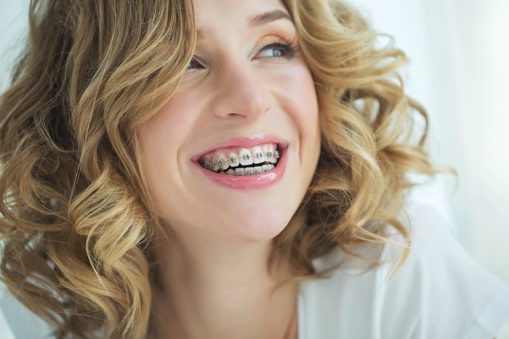 Young woman in braces - Phase I Treatment
