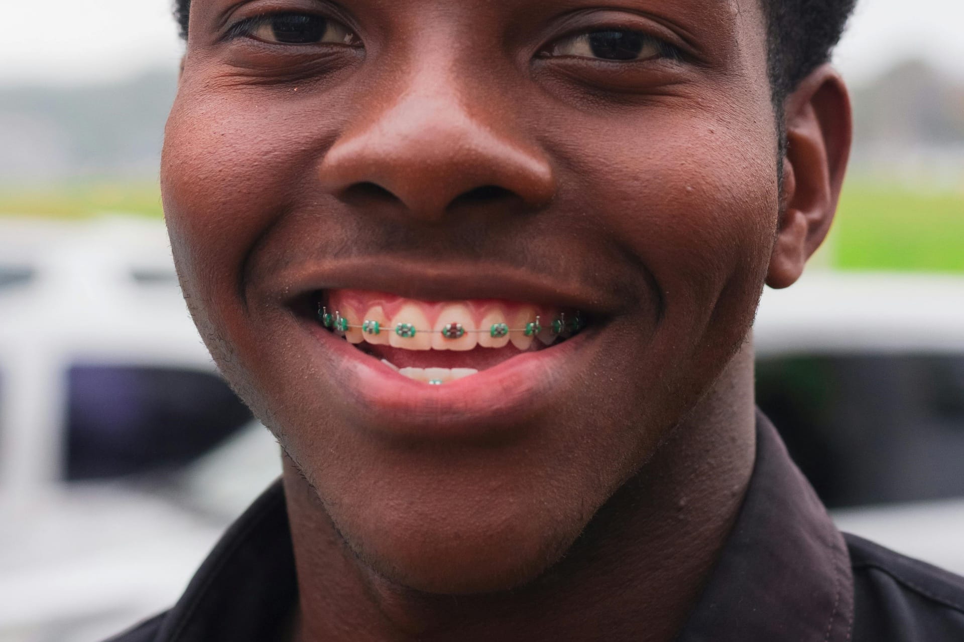 The different types of braces include metal, ceramic, lingual, and clear. 